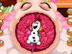 Anna's Brain Surgery